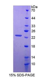 Figure 1. SDS-PAGE