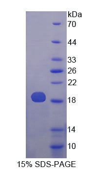 Figure 1. SDS-PAGE