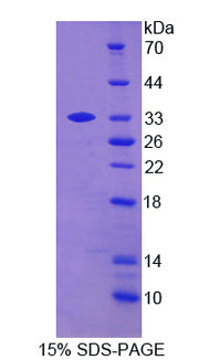 Figure 1. SDS-PAGE