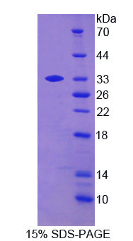 Figure 1. SDS-PAGE