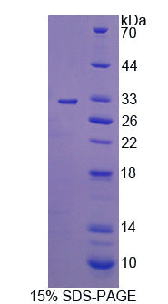 Figure 1. SDS-PAGE