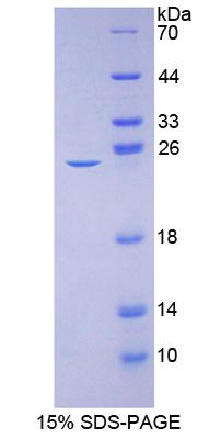 Figure 1. SDS-PAGE