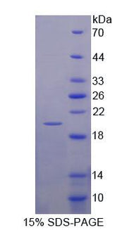 Figure 1. SDS-PAGE