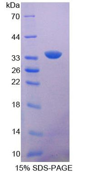 Figure 1. SDS-PAGE