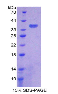 Figure 1. SDS-PAGE