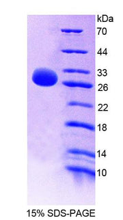 Figure 1. SDS-PAGE