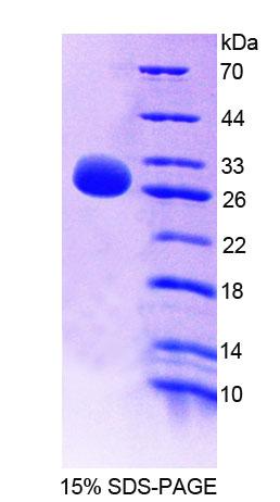 Figure 1. SDS-PAGE