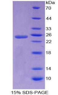 Figure 1. SDS-PAGE