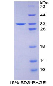 Figure 1. SDS-PAGE