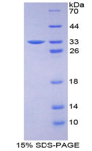 Figure 1. SDS-PAGE