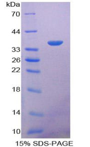 Figure 1. SDS-PAGE