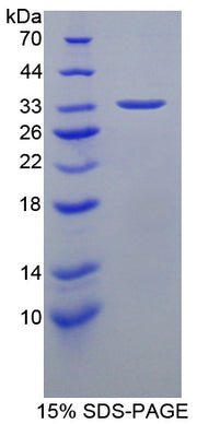 Figure 1. SDS-PAGE