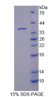 Figure 1. SDS-PAGE