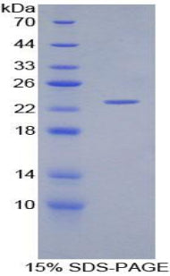 Figure 1. SDS-PAGE