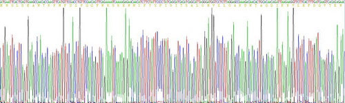 Recombinant Human Serpin B3 (SERPINB3)