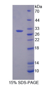 Figure 1. SDS-PAGE