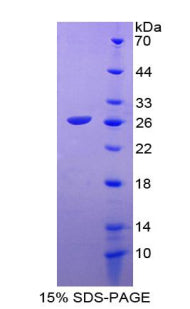 Figure 1. SDS-PAGE