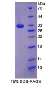 Figure 1. SDS-PAGE