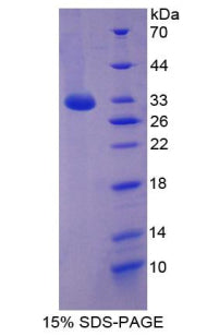 Figure 1. SDS-PAGE