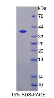 Figure 1. SDS-PAGE