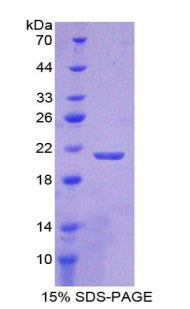 Figure 1. SDS-PAGE