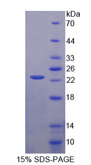 Figure 1. SDS-PAGE