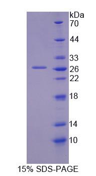Figure 1. SDS-PAGE