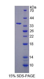 Figure 1. SDS-PAGE