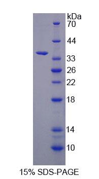 Figure 1. SDS-PAGE
