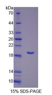 Figure 1. SDS-PAGE