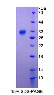 Figure 1. SDS-PAGE