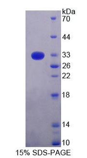 Figure 1. SDS-PAGE