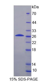 Figure 1. SDS-PAGE