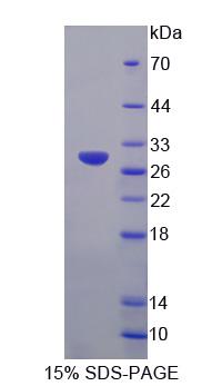 Figure 1. SDS-PAGE