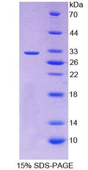 Figure 1. SDS-PAGE