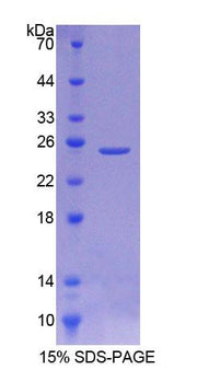 Figure 1. SDS-PAGE