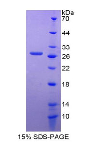 Figure 1. SDS-PAGE