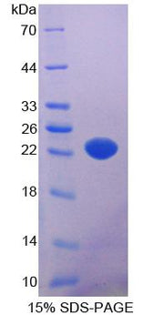 Figure 1. SDS-PAGE