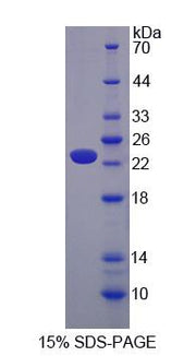 Figure 1. SDS-PAGE