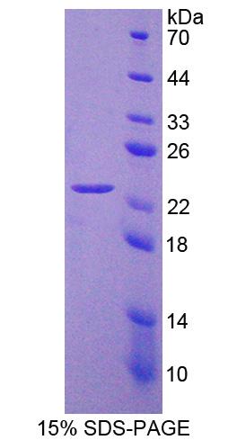 Figure 1. SDS-PAGE