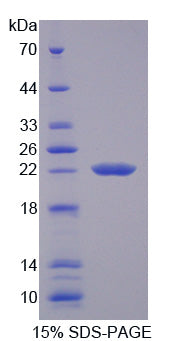 Figure 1. SDS-PAGE