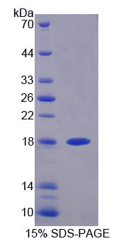 Figure 1. SDS-PAGE