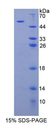 Figure 1. SDS-PAGE