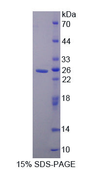 Figure 1. SDS-PAGE
