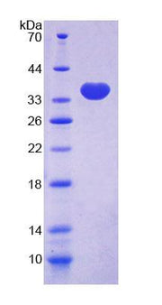 Figure 1. SDS-PAGE