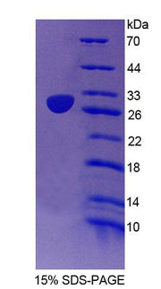 Figure 1. SDS-PAGE