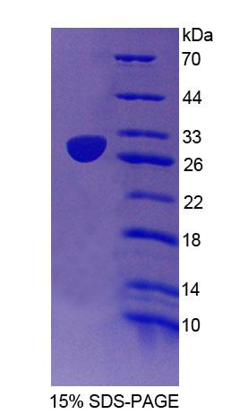 Figure 1. SDS-PAGE