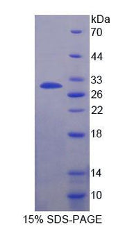 Figure 1. SDS-PAGE