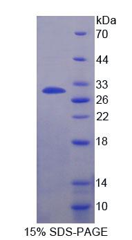 Figure 1. SDS-PAGE