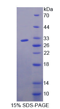 Figure 1. SDS-PAGE